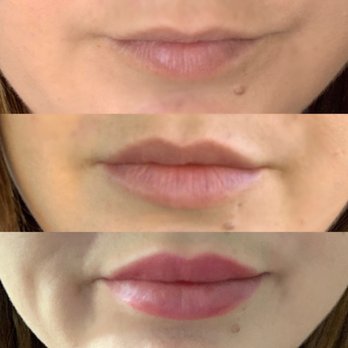 RiverwalkMD Aesthetics - Medical Spas Near Me - Corona, California