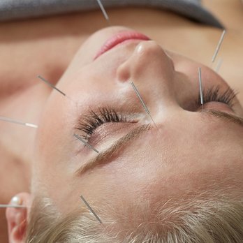 Chillax OM - Facial Acupuncture with Dr. Andrea Renee, DACM, L.Ac. - Acupuncture Near Me - Evergreen, Colorado
