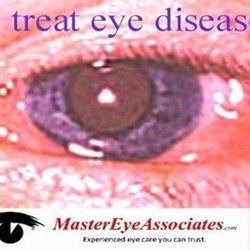 Open Eyes Vision Center - We specialize in treatment of pink eye