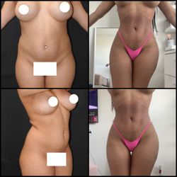 Constantino Mendieta, MD FACS - 4 Beauty