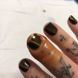 This is a picture from urgent care right before they made an incision around my nail bed to release the pressure from the infection.