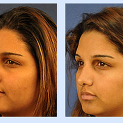 Florida Ear, Nose, Throat & Facial Plastic Surgery Center - Florida Ear Nose Throat & Facial Plastic Surgery Center