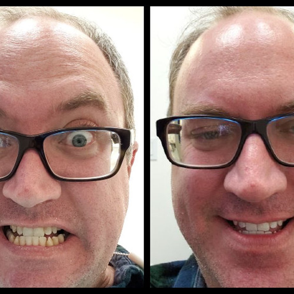Got whitening done and loved the results. Confidence restored! Thank you, Ileana!! Got whitening done and loved the results. Confidence restored! Thank you, Ileana!!