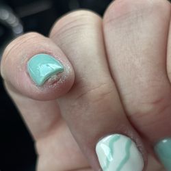 The wound on my pinky where he just kept filing.