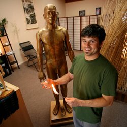 Jordan Schreiber, L.Ac. - Jordan Schreiber, L.Ac. demonstrating fire cupping during his earlier days as Felton Community Acupuncture.
