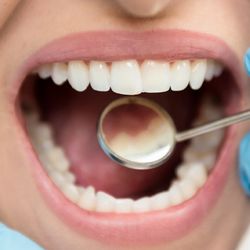 Braasch Oral Surgery 
