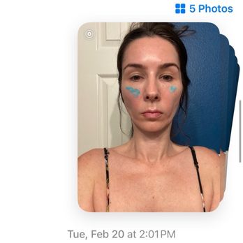 The Retreat Restorative & Aesthetic - Texts showing I sent the a video and pics within days of the damage caused and was ignored. - Medical Spas Near Me - Rockwall, Texas