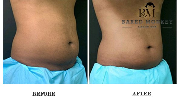 Bared Monkey Laser Spa by null