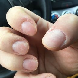 Worst manicure of my life