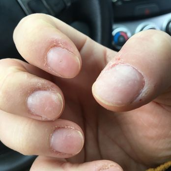 Elite Nails - Worst manicure of my life - Nail Salons Near Me - Manchester, New Hampshire