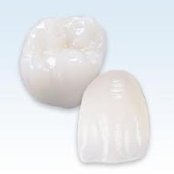 Vijeyta Bhatia, DDS - Natural tooth colored crowns and fillings