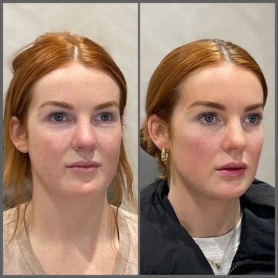 The Fitz Aesthetic Club by null