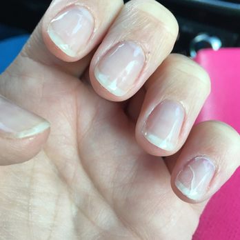 Head To Toe Day Spa - Peeling polish shortly after I arrived home. - Skin Care Near Me - Seattle, Washington