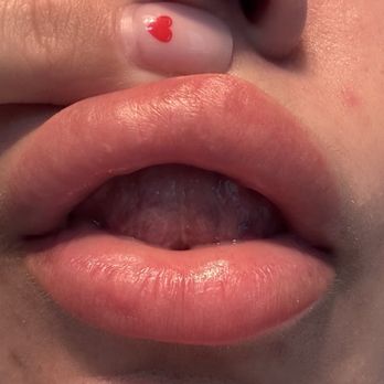 Not Just Lips - Lumps by Olga - Aestheticians Near Me - New York, New York Not Just Lips - Lumps by Olga - Aestheticians Near Me - New York, New York