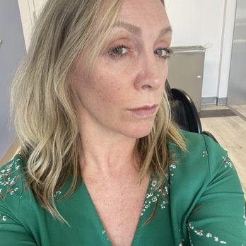 Vela Beauty Lab - RF face and neck tightening a week after first session! - Skin Care Near Me - Lafayette, California Vela Beauty Lab - RF face and neck tightening a week after first session! - Skin Care Near Me - Lafayette, California