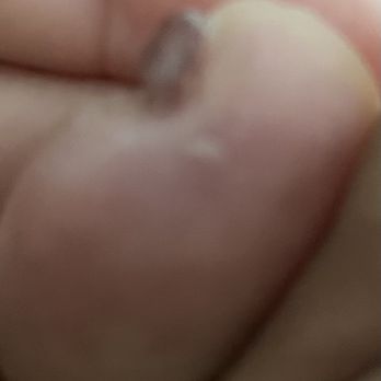 Serene Nails - Hang nail - Nail Salons Near Me - San Jose, California