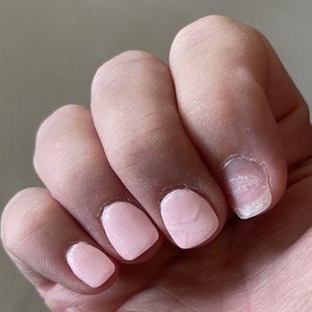 Vidura Spa - Cracked and one fell off after 6 days - Massage Near Me - San Antonio, Texas