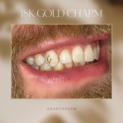 KARUNA Tooth Gems & Teeth Whitening - 18 Gold Charm.