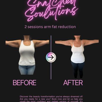 Snatched Soulutions - Arm fat reduction - Medical Spas Near Me - Weirton, West Virginia Snatched Soulutions - Arm fat reduction - Medical Spas Near Me - Weirton, West Virginia