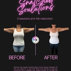 Snatched Soulutions - Arm fat reduction