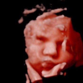 Baby Bump - Ultrasound Imaging Centers Near Me - Clarksville, Tennessee