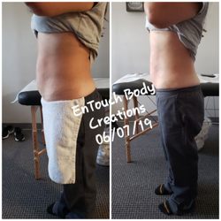 Entouch Body Creations - Lipocavitation