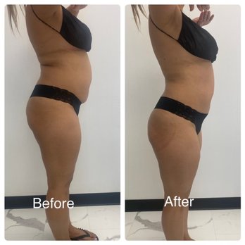 Beyoutifull Body - You can definitely see a difference, my initial treatment - Beauty & Spas Near Me - Aiea, Hawaii Beyoutifull Body - You can definitely see a difference, my initial treatment - Beauty & Spas Near Me - Aiea, Hawaii