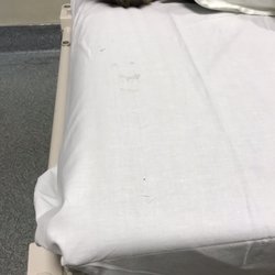 Parkview Hospital - Bed had hair and looked like boogers wipes all over it !