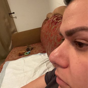 Aaron Kosins, MD - Before surgery - Cosmetic Surgeons Near Me - Newport Beach, California
