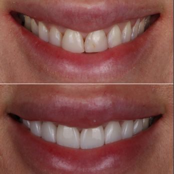 Encino Dental Group - General Dentistry Near Me - Encino, California Encino Dental Group - General Dentistry Near Me - Encino, California