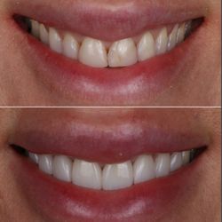 Encino Dental Group