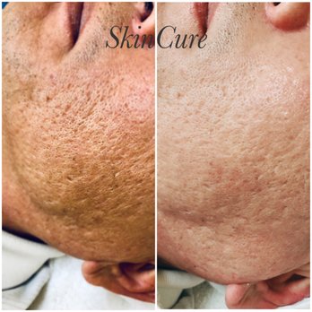 SkinCure - Skin Care Near Me - Santa Clara, California