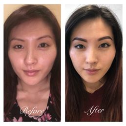 My before and after pic My before and after pic
