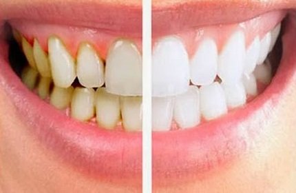 Connexions Dental Hygiene Logo