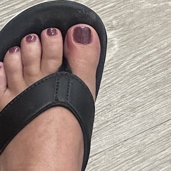 M Nails & Spa - Toe infection - Nail Salons Near Me - Orlando, Florida