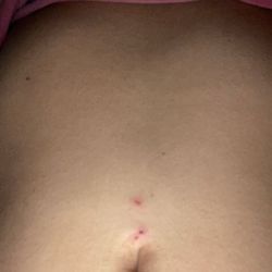 York Ink - The 2x that she pierced me cause they gave her the wrong sizes jewelry, and it is placed so high!!!