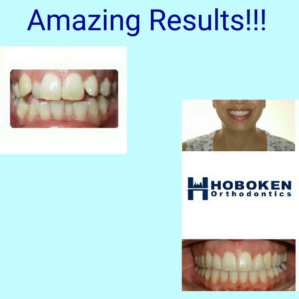 HOBOKEN ORTHODONTICS Updated August 2024 28 Reviews 928