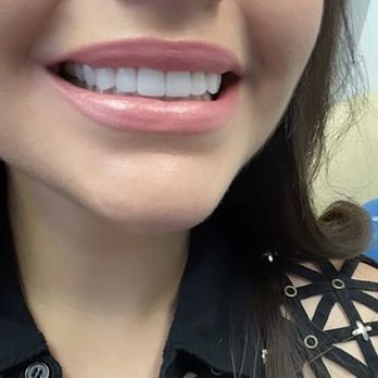 Adriana Barrera, DDS - Barrera Advanced Dentistry - Best place for VENEERS in Torrance! - Cosmetic Dentists Near Me - Torrance, California Adriana Barrera, DDS - Barrera Advanced Dentistry - Best place for VENEERS in Torrance! - Cosmetic Dentists Near Me - Torrance, California