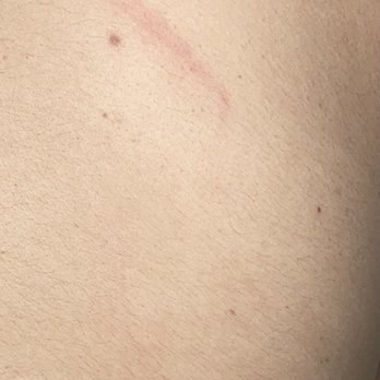 The Address - One of the marks on my back from tonight from the "security guard" - American Near Me - Houston, Texas