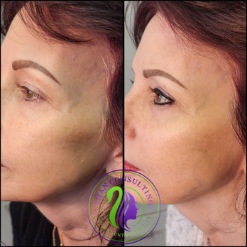 Swan Consulting Permanent Cosmetics - The proof is in the pic. - Permanent Makeup Near Me - Glen Burnie, Maryland