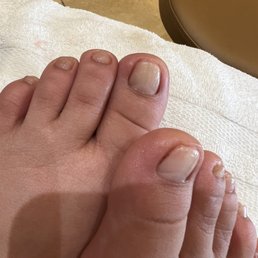 Clean nails