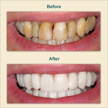 Anthony J Tisoncik, DDS - General Dentistry Near Me - Palos Hills, Illinois Anthony J Tisoncik, DDS - General Dentistry Near Me - Palos Hills, Illinois