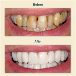 Anthony J Tisoncik, DDS