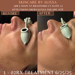 Skincare By Alissa - 02Rx