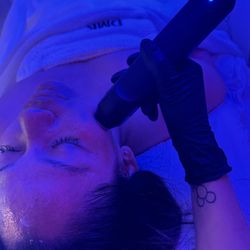 Yaz Aesthetics - Glo2Facial Luxe Treatment