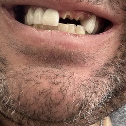 Derrek Henrie DDS - 2 broken teeth and an abscess and was refused service for no reason