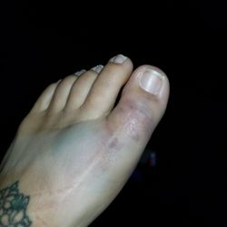Millward Gary J Podiatrist - He never prescribed me a thing, and when I asked I was denied