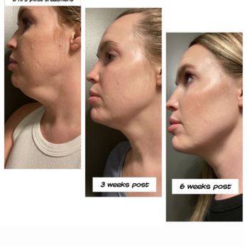 Morph Aesthetics - Aestheticians Near Me - Phoenix, Arizona Morph Aesthetics - Aestheticians Near Me - Phoenix, Arizona