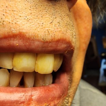 Cancún Dental Specialists - Oral Surgeons Near Me - Cancún, ROO Cancún Dental Specialists - Oral Surgeons Near Me - Cancún, ROO