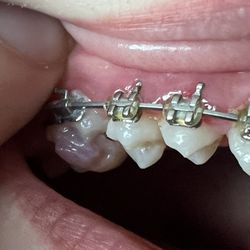 Busby and Webb Orthodontics - Salisbury-Mocksville